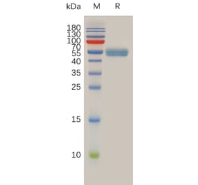 SDS-PAGE - Recombinant Human RNF43 Protein (Fc Tag) (A318012) - Antibodies.com
