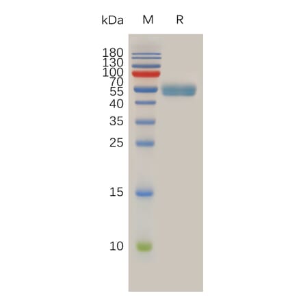 SDS-PAGE - Recombinant Human RNF43 Protein (Fc Tag) (A318012) - Antibodies.com