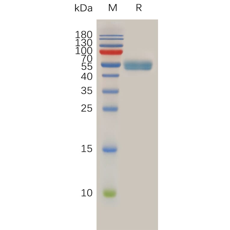 SDS-PAGE - Recombinant Human RNF43 Protein (Fc Tag) (A318012) - Antibodies.com