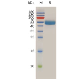 SDS-PAGE - Recombinant Human RNF43 Protein (Fc Tag) (A318013) - Antibodies.com