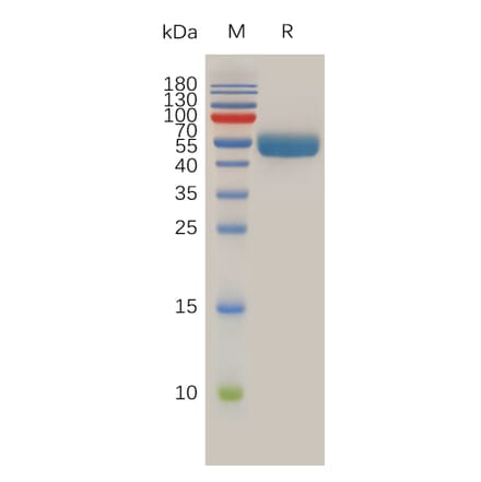 SDS-PAGE - Recombinant Human RNF43 Protein (Fc Tag) (A318013) - Antibodies.com