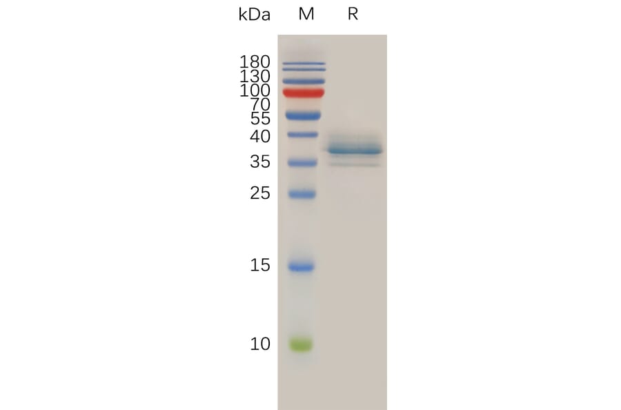 SDS-PAGE - Recombinant Human Annexin A1/ANXA1 Protein (6×His Tag) (A318014) - Antibodies.com