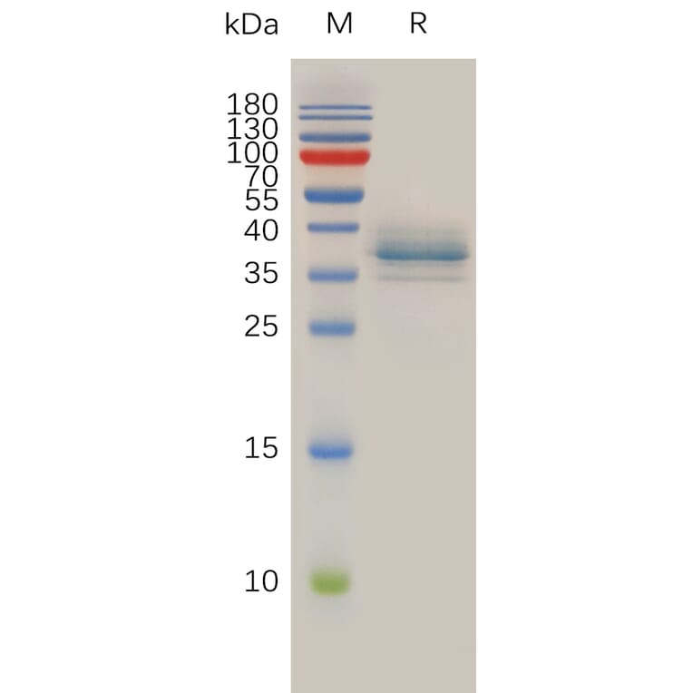 SDS-PAGE - Recombinant Human Annexin A1/ANXA1 Protein (6×His Tag) (A318014) - Antibodies.com