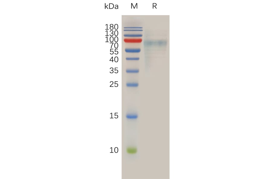 SDS-PAGE - Recombinant Human SLC39A6/ZIP-6 Protein (6×His Tag) (A318015) - Antibodies.com