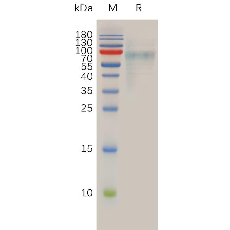 SDS-PAGE - Recombinant Human SLC39A6/ZIP-6 Protein (6×His Tag) (A318015) - Antibodies.com