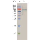 SDS-PAGE - Recombinant Human SLC39A6/ZIP-6 Protein (6×His Tag) (A318015) - Antibodies.com