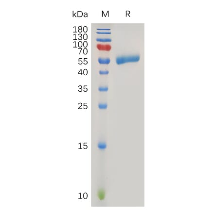 SDS-PAGE - Recombinant Human CLEC4C Protein (Fc Tag) (A318017) - Antibodies.com
