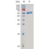 SDS-PAGE - Recombinant Human CLEC4C Protein (Fc Tag) (A318017) - Antibodies.com