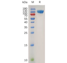 SDS-PAGE - Recombinant Human CD276 Protein (Fc Tag) (A318018) - Antibodies.com