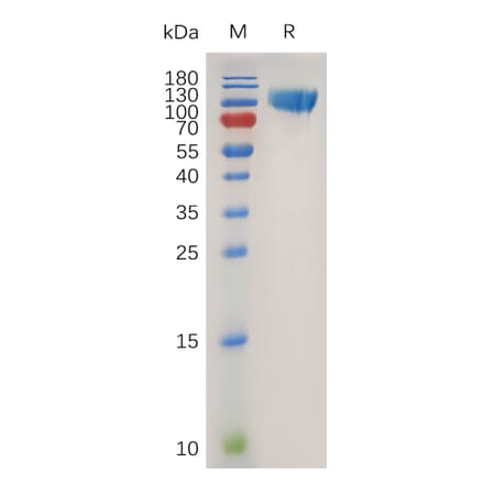 SDS-PAGE - Recombinant Human CD276 Protein (Fc Tag) (A318018) - Antibodies.com