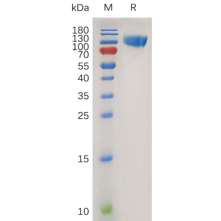 SDS-PAGE - Recombinant Human CD276 Protein (Fc Tag) (A318018) - Antibodies.com