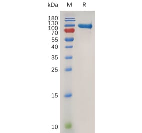 SDS-PAGE - Recombinant Human MMP9 Protein (6×His Tag) (A318019) - Antibodies.com