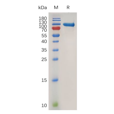 SDS-PAGE - Recombinant Human MMP9 Protein (6×His Tag) (A318019) - Antibodies.com