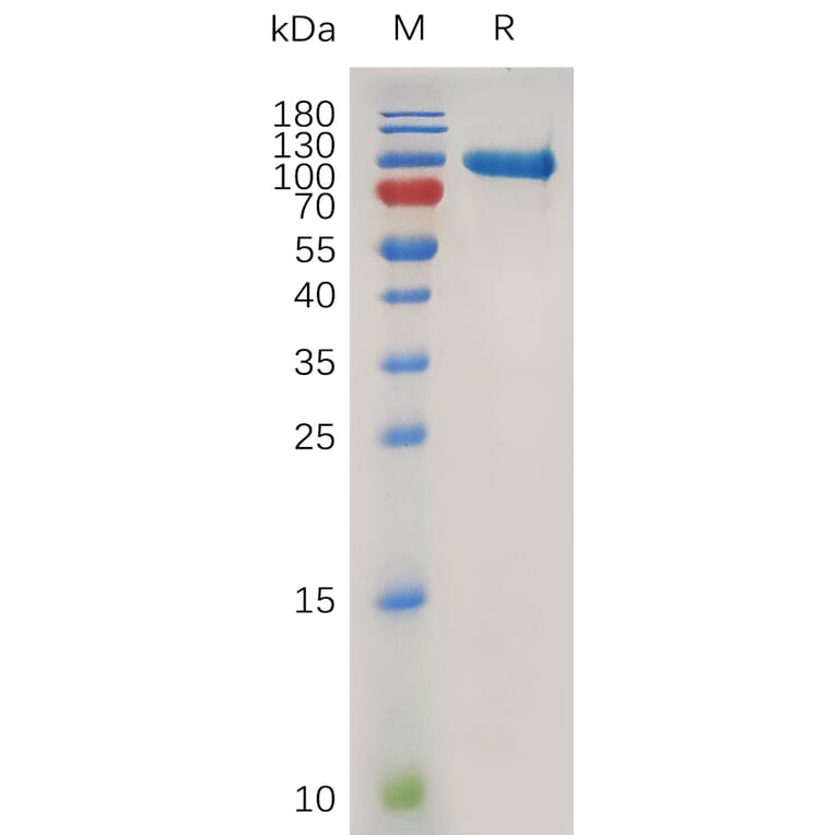 SDS-PAGE - Recombinant Human MMP9 Protein (6×His Tag) (A318019) - Antibodies.com