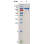 SDS-PAGE - Recombinant Human MMP9 Protein (6×His Tag) (A318019) - Antibodies.com