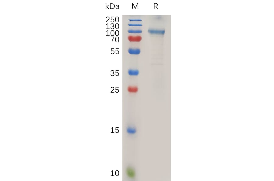 SDS-PAGE - Recombinant Human ADAM15 Protein (Fc Tag) (A318020) - Antibodies.com