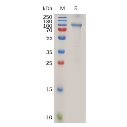 SDS-PAGE - Recombinant Human ADAM15 Protein (Fc Tag) (A318020) - Antibodies.com