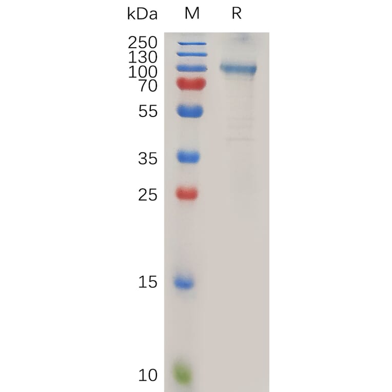 SDS-PAGE - Recombinant Human ADAM15 Protein (Fc Tag) (A318020) - Antibodies.com