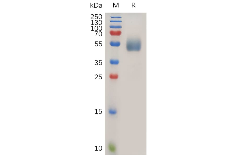 SDS-PAGE - Recombinant Human IL-1R-2 Protein (6×His Tag) (A318024) - Antibodies.com