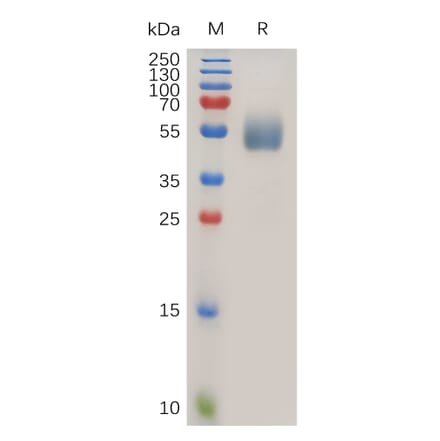 SDS-PAGE - Recombinant Human IL-1R-2 Protein (6×His Tag) (A318024) - Antibodies.com