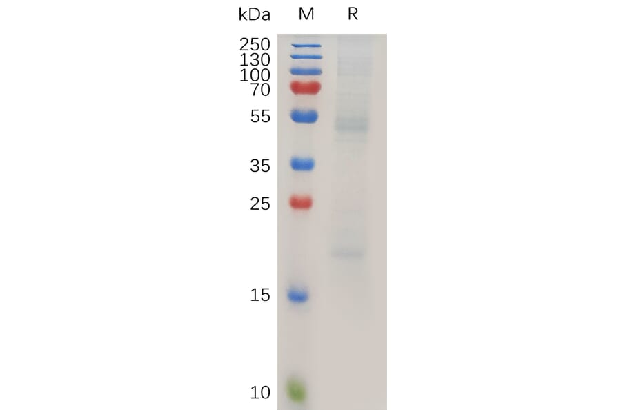 SDS-PAGE - Recombinant Human RAGE Protein (6×His Tag) (A318025) - Antibodies.com