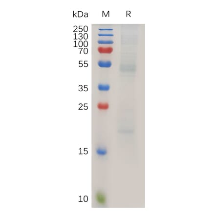 SDS-PAGE - Recombinant Human RAGE Protein (6×His Tag) (A318025) - Antibodies.com