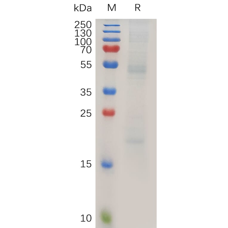 SDS-PAGE - Recombinant Human RAGE Protein (6×His Tag) (A318025) - Antibodies.com