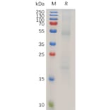 SDS-PAGE - Recombinant Human RAGE Protein (6×His Tag) (A318025) - Antibodies.com