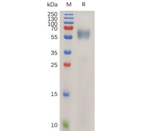 SDS-PAGE - Recombinant Human IL-1RAcP Protein (6×His Tag) (A318026) - Antibodies.com
