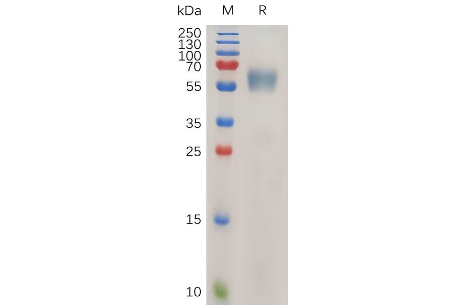 SDS-PAGE - Recombinant Human IL-1RAcP Protein (6×His Tag) (A318026) - Antibodies.com