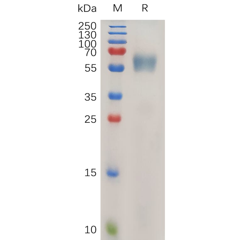 SDS-PAGE - Recombinant Human IL-1RAcP Protein (6×His Tag) (A318026) - Antibodies.com