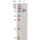SDS-PAGE - Recombinant Human IL-1RAcP Protein (6×His Tag) (A318026) - Antibodies.com