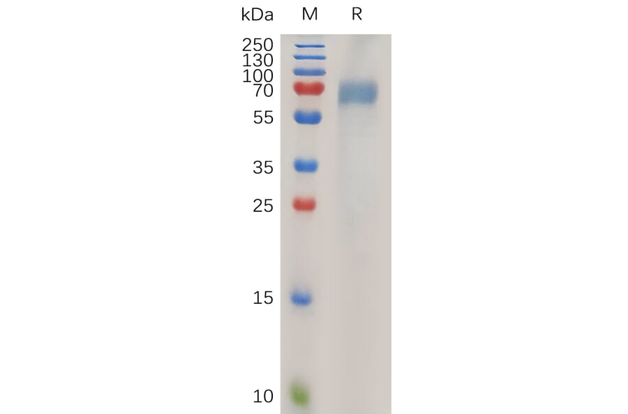SDS-PAGE - Recombinant Human ILT-4 Protein (6×His Tag) (A318027) - Antibodies.com