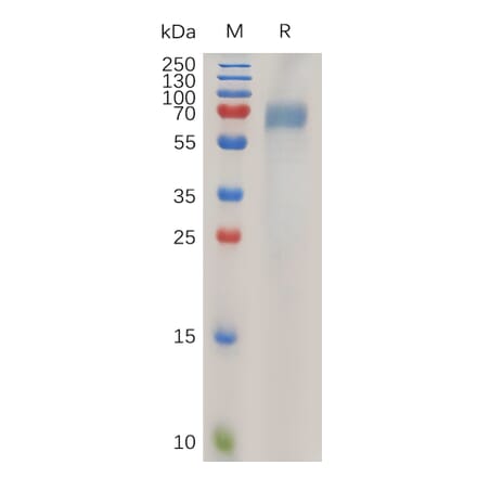 SDS-PAGE - Recombinant Human ILT-4 Protein (6×His Tag) (A318027) - Antibodies.com