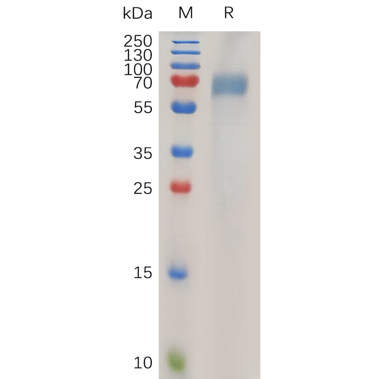SDS-PAGE - Recombinant Human ILT-4 Protein (6×His Tag) (A318027) - Antibodies.com