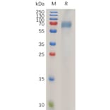 SDS-PAGE - Recombinant Human ILT-4 Protein (6×His Tag) (A318027) - Antibodies.com