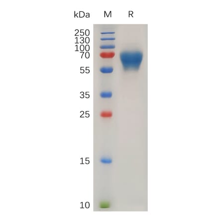 SDS-PAGE - Recombinant Human LIF Protein (Fc Tag) (A318028) - Antibodies.com