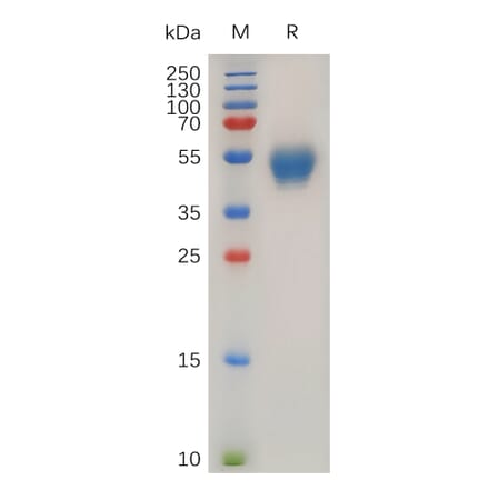 SDS-PAGE - Recombinant Human CD63 Protein (Fc Tag) (A318029) - Antibodies.com