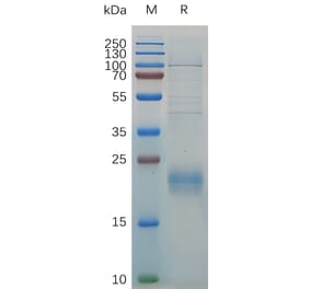 SDS-PAGE - Recombinant Human CLEC2D Protein (6×His Tag) (A318030) - Antibodies.com