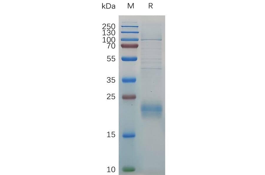 SDS-PAGE - Recombinant Human CLEC2D Protein (6×His Tag) (A318030) - Antibodies.com