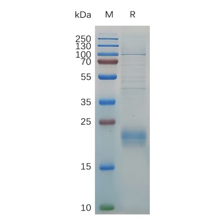 SDS-PAGE - Recombinant Human CLEC2D Protein (6×His Tag) (A318030) - Antibodies.com