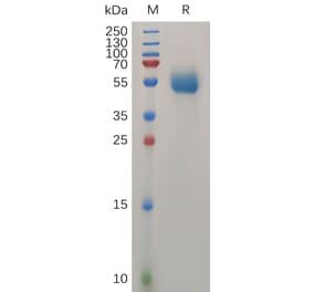 SDS-PAGE - Recombinant Human IL-31 Protein (Fc Tag) (A318031) - Antibodies.com