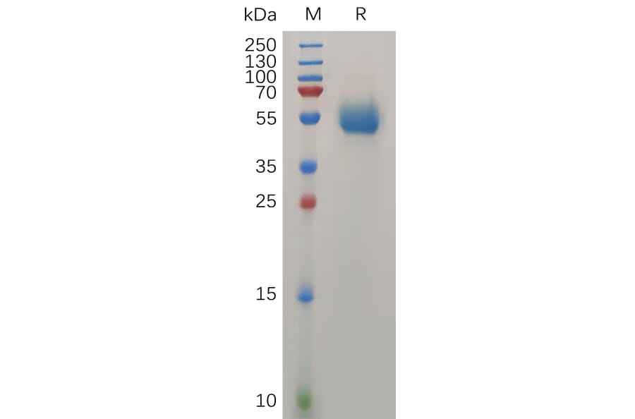 SDS-PAGE - Recombinant Human IL-31 Protein (Fc Tag) (A318031) - Antibodies.com