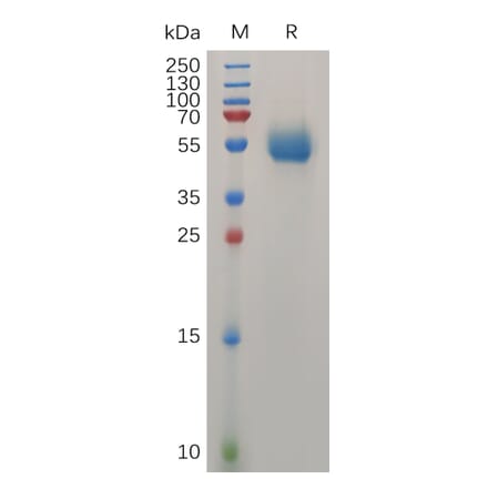 SDS-PAGE - Recombinant Human IL-31 Protein (Fc Tag) (A318031) - Antibodies.com