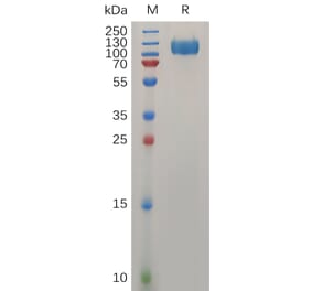 SDS-PAGE - Recombinant Human Interferon alpha/beta Receptor 1 Protein (Fc Tag) (A318032) - Antibodies.com