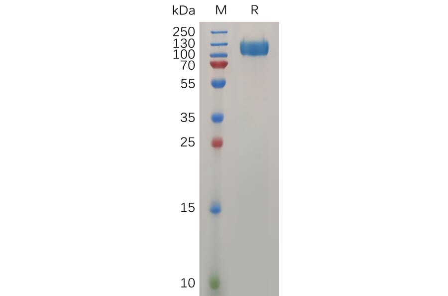SDS-PAGE - Recombinant Human Interferon alpha/beta Receptor 1 Protein (Fc Tag) (A318032) - Antibodies.com