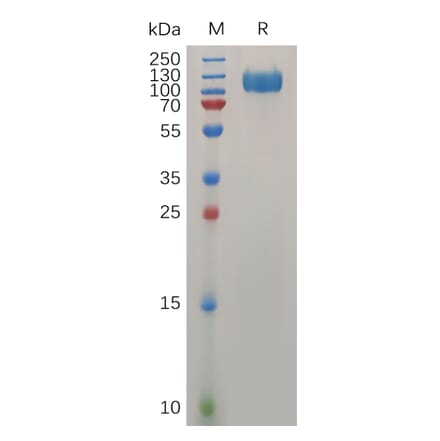 SDS-PAGE - Recombinant Human Interferon alpha/beta Receptor 1 Protein (Fc Tag) (A318032) - Antibodies.com