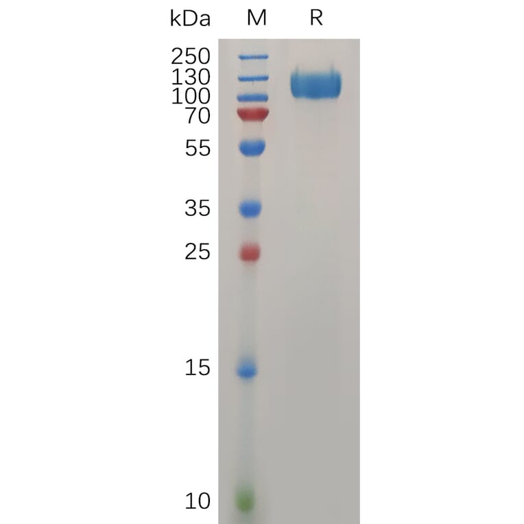 SDS-PAGE - Recombinant Human Interferon alpha/beta Receptor 1 Protein (Fc Tag) (A318032) - Antibodies.com