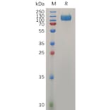 SDS-PAGE - Recombinant Human Interferon alpha/beta Receptor 1 Protein (Fc Tag) (A318032) - Antibodies.com