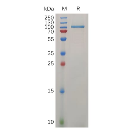 SDS-PAGE - Recombinant Human LRIG1 Protein (6×His Tag) (A318033) - Antibodies.com